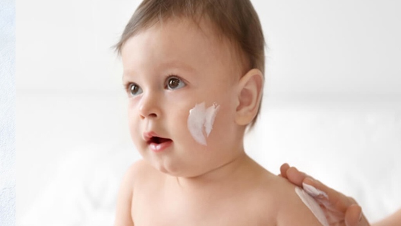 Chàm sữa ảnh hưởng đến bé như thế nào?