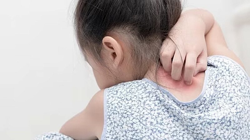 Mụn nhọt ở trẻ