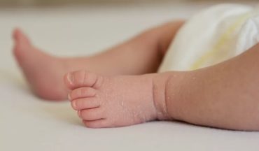 Tình trạng khô da ở trẻ nhỏ